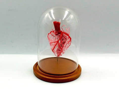 Corrosion Casting - 1 Gold Coast 0